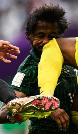 lesão de goleiro da arábia